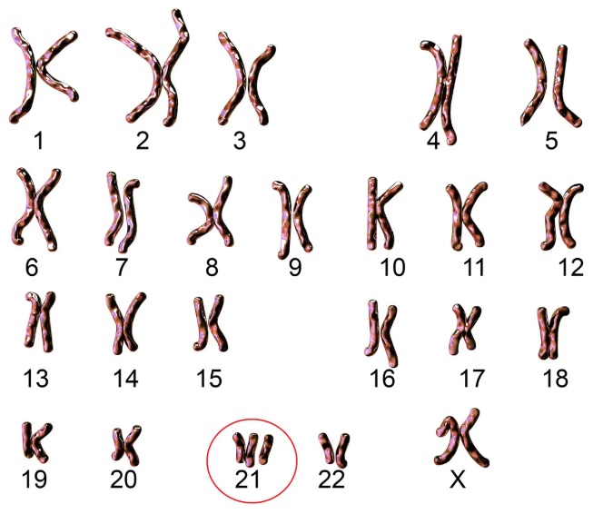 Understanding Genetic Karyotype and Its Role in Fertility