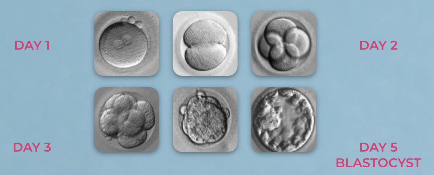 Why Do 85% of Eggs Fail to Develop into Blastocyst Embryos?